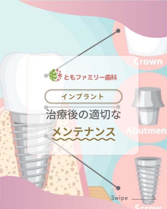 こんにちは！
ともファミリー歯科です😊

インプラント治療後のメンテナンスについてご紹介いたします！

インプラントはメンテナンス次第で寿命が大きく変わる為
治療のやり直しが必要になることも…⚡️

特に、インプラント周囲炎は
歯周病と同じようにプラークや歯石が原因で起こります！

数か月一度の歯科医院での定期検診や、
自宅での日常のオーラルケアを徹底し、
インプラントを健康に保ちましょう✨！

⬇️HPもぜひご覧下さい⬇️
https://www.tomo-dent.com/

#歯科医院　#歯ブラシ　#小児歯科　#小児矯正　#小児　#求人　#大阪府　#大阪市　#ともファミリー歯科　#歯科助手　#口腔習慣　#口腔機能　#マルチブラケット装置　#マウスピース　#インプラント矯正　#外科的矯正 #フッ素