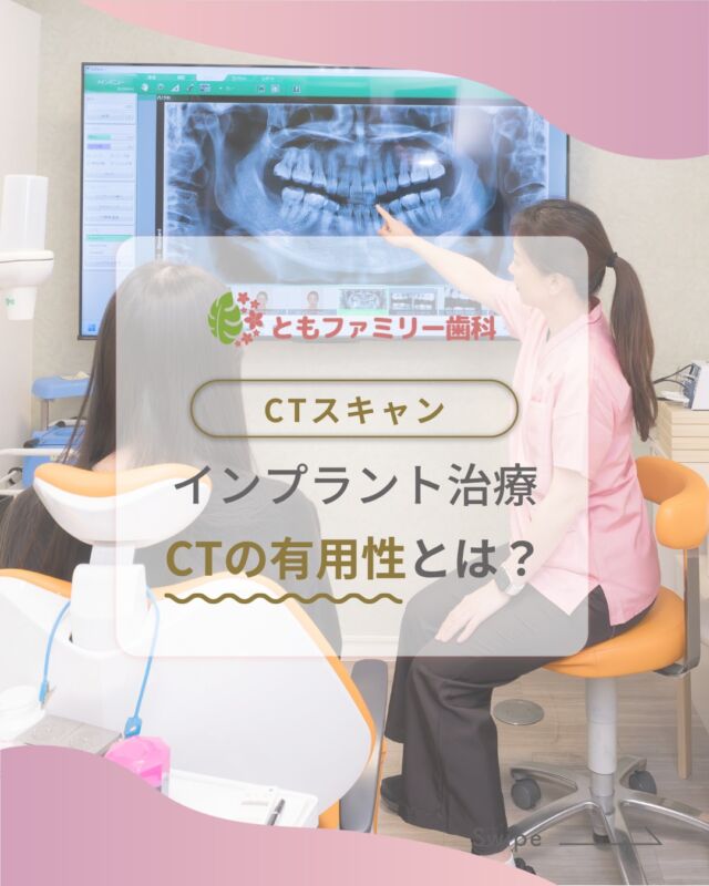 こんにちは！
ともファミリー歯科です😊

CTスキャンの有用性についてご紹介いたします！

インプラント治療でも使用されるCTスキャン🦷
骨の状態を正確に把握することで、
患者様に合わせた治療計画をたてることができます✨

治療時間の短縮や、痛みの軽減にもつながり、
結果的に術後の回復の早さが期待できます❗️

歯科医院を選ぶ際には、
CTスキャンを活用した診断と治療を行っているか？を
基準に選ぶこともご自身の治療のために大切です🌿

⬇️HPもぜひご覧下さい⬇️
https://www.tomo-dent.com/

#歯科医院　#歯ブラシ　#小児歯科　#小児矯正　#小児　#求人　#大阪府　#大阪市　#ともファミリー歯科　#歯科助手　#口腔習慣　#口腔機能　#マルチブラケット装置　#マウスピース　#インプラント矯正　#外科的矯正 #フッ素