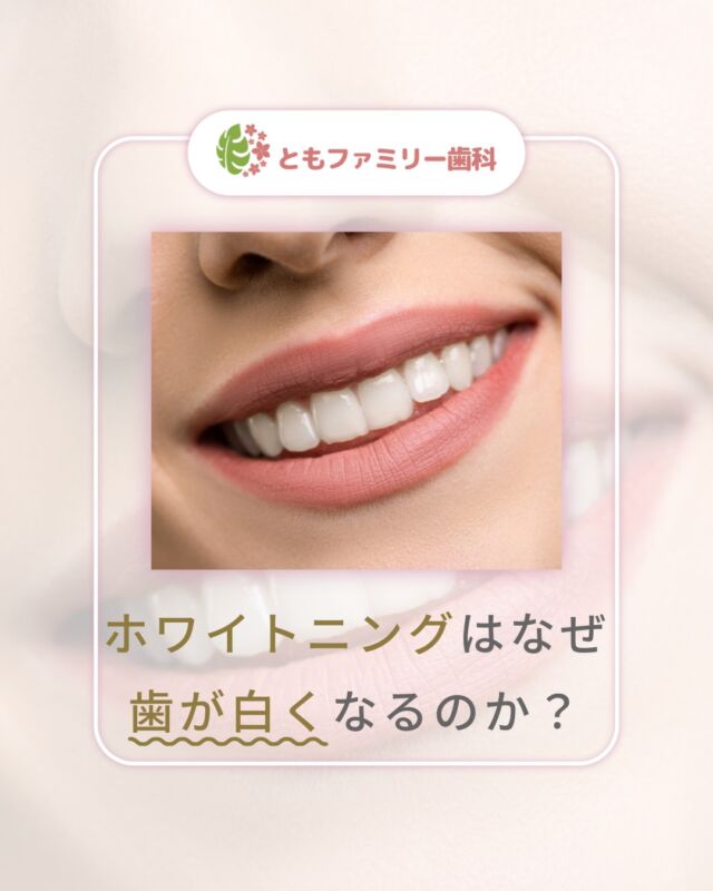 こんにちは！
ともファミリー歯科です😊

ホワイトニングの仕組みについてご紹介いたします！

ホワイトニングはなぜ歯が白くなるのか🦷？
それは過酸化水素が含まれる薬剤の作用で色素を分解し
明るく白く見えるようになるためです✨

歯が1–2トーン明るくなるだけで、
自信や清潔感の向上も期待できます❗️

ただし、永久的な効果を保証するものではない為、
効果を持続させるためには定期的なメンテナンスが必要です🌿

⬇️HPもぜひご覧下さい⬇️
https://www.tomo-dent.com/

#歯科医院　#歯ブラシ　#小児歯科　#小児矯正　#小児　#求人　#大阪府　#大阪市　#ともファミリー歯科　#歯科助手　#口腔習慣　#口腔機能　#マルチブラケット装置　#マウスピース　#インプラント矯正　#外科的矯正 #フッ素