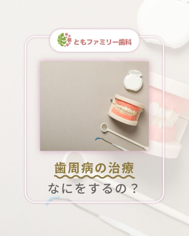 こんにちは！
ともファミリー歯科です😊

歯周病の治療についてご紹介いたします！

基本方針に沿って
歯周病の段階に合わせた治療を進めていきますが
改善が難しい歯周病には外科的治療
を行う場合もあります🌿

最終的には定期的な診察と
正しいセルフケアが不可欠な歯周病🦷
定期的な検診に通院し、
健康な歯ぐきを保ち続けましょう✨

⬇️HPもぜひご覧下さい⬇️
https://www.tomo-dent.com/

#歯科医院　#歯ブラシ　#小児歯科　#小児矯正　#小児　#求人　#大阪府　#大阪市　#ともファミリー歯科　#歯科助手　#口腔習慣　#口腔機能　#マルチブラケット装置　#マウスピース　#インプラント矯正　#外科的矯正 #フッ素