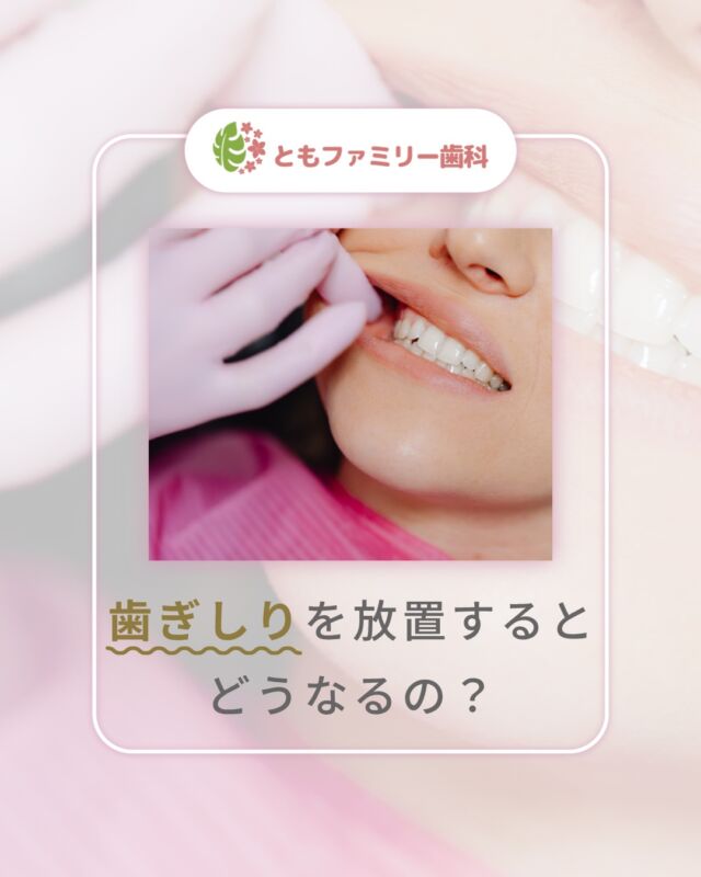 こんにちは！
ともファミリー歯科です😊

歯ぎしりについてご紹介いたします！

「多少の歯ぎしりなら問題ない？」
と思う方もいるかもしれませんが
放置すると歯の寿命を縮めるような
深刻なトラブルを引き起こす可能性も⚡️

ご自身の習慣を振り返ることも大切です✨
顎のだるさや歯のすり減りなどの
サインを見逃さず不安なことがあれば
いつでもご相談ください🌿

⬇️HPもぜひご覧下さい⬇️
https://www.tomo-dent.com/

#歯科医院　#歯ブラシ　#小児歯科　#小児矯正　#小児　#求人　#大阪府　#大阪市　#ともファミリー歯科　#歯科助手　#口腔習慣　#口腔機能　#マルチブラケット装置　#マウスピース　#インプラント矯正　#外科的矯正 #フッ素